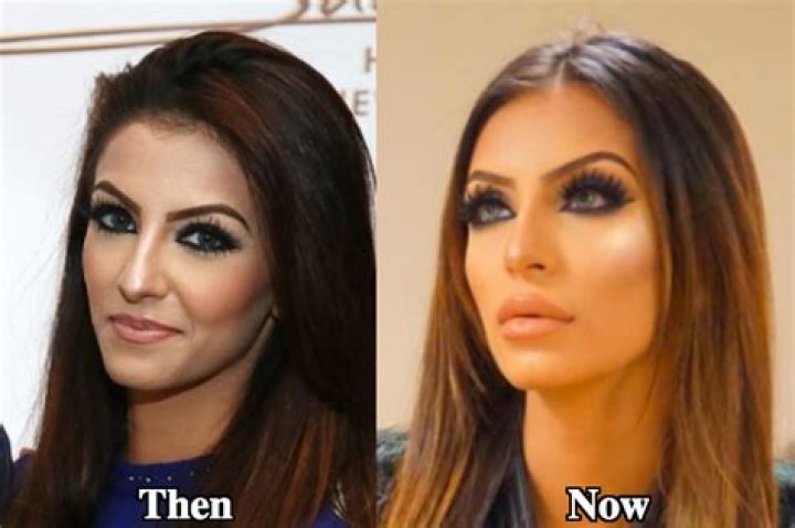 Faryal Makhdoom's Before Plastic Surgery: Her Current Appearance!