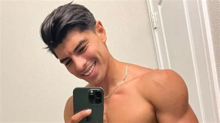 Horacio From The Challenge Head Scar; Reddit Update